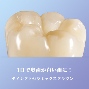 ３Mダイレクトクラウンイメージ